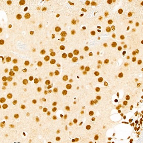 Anti -CTCF Rabbit pAb